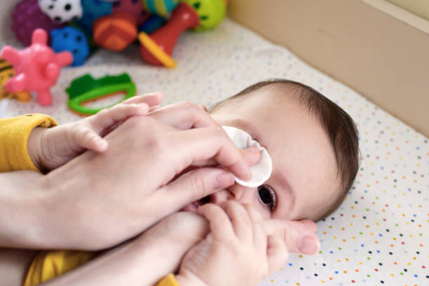 How To Care your Baby’s Eyes?