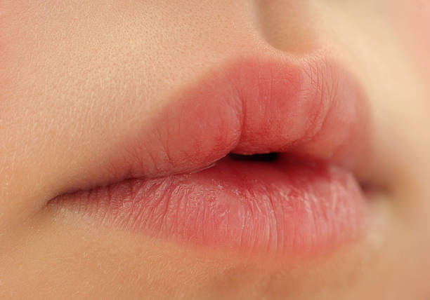 Newborn Chapped Lips : Cause and Treatment