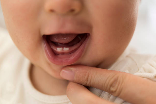 Baby Teeth Growth Stages