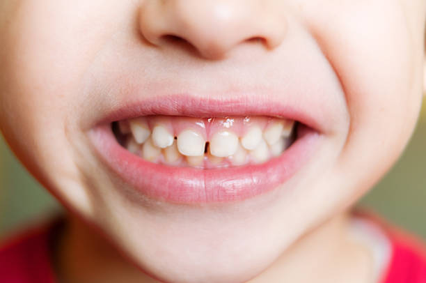 Baby Teeth Growth Stages